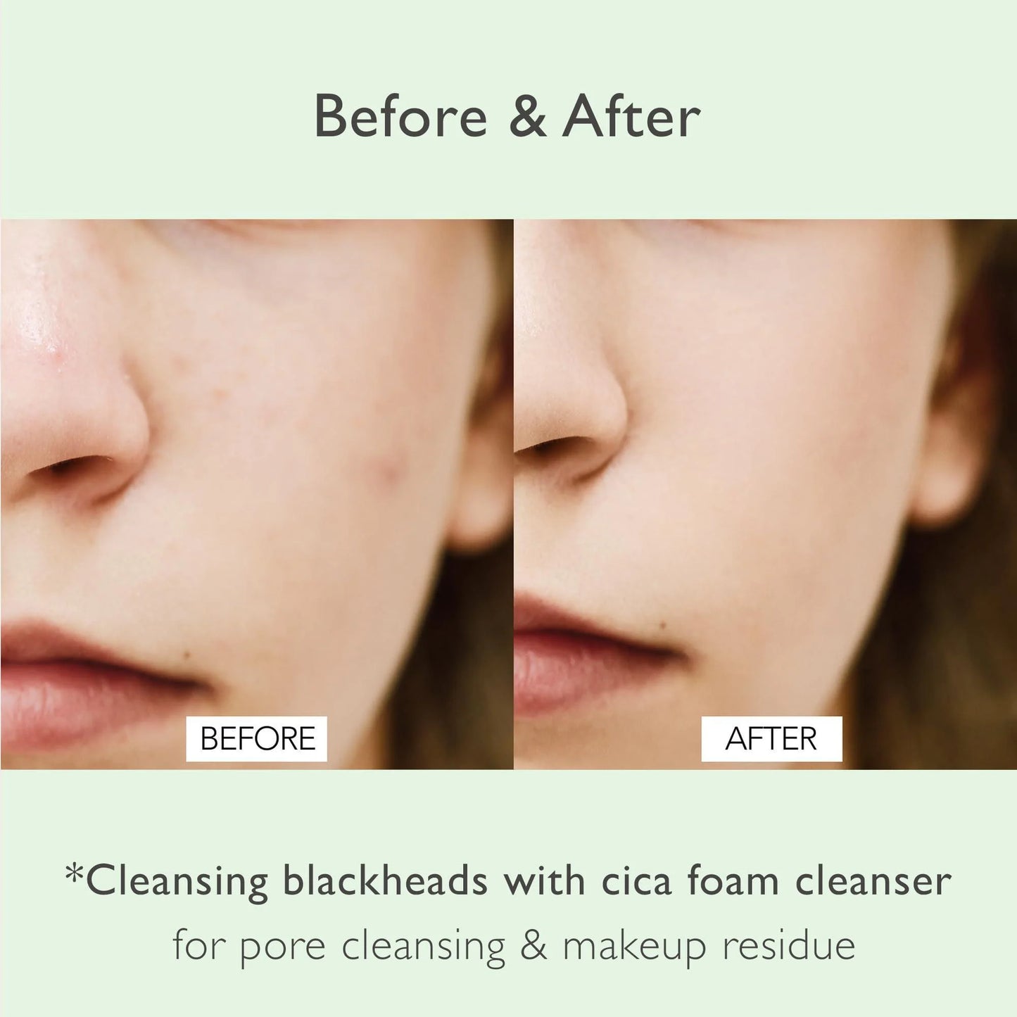 Cica Daily Pore Cleansing Foam – Sebum Control + Hydration (4.05 fl oz)